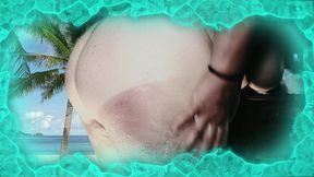 beach sunburn bbw