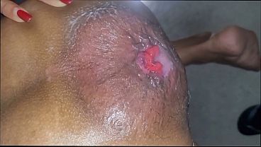 Olha como ficou meu cu de tanto p&ecirc_nis que j&aacute_ entrou e gozou dentro, eu fa&ccedil_o um prolapso anal gigante