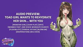 Toad Girl Wants To Rehydrate Her Skin With You