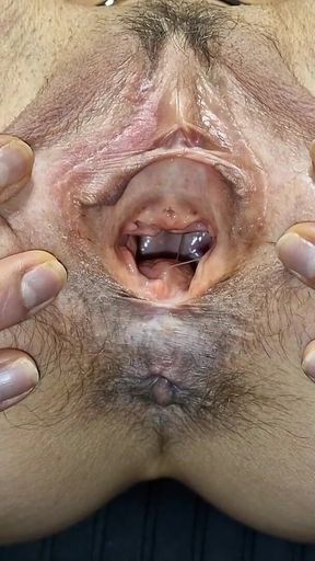 Gynecology Chair Play and Gaping