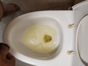 Asian gay peeing in his micropenis.