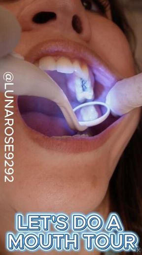 LET’S DO A MOUTH TOUR! LETS GO OVER MY DENTAL HISTORY! DID YOU KNOW I HAVE SILVER AMALGAM FILLINGS!?🧤🦷🪥