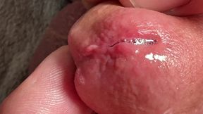 Fingers in the Penis. Hole in Penis Penetration.