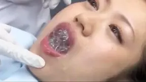 Seductive Dentist Tempts Patient With Hot Oral Action
