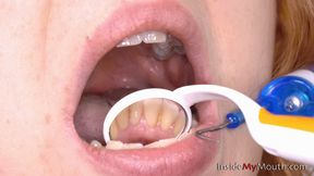 Inside My Mouth - Alex shows her mouth and got a mouth exam (HD quality)