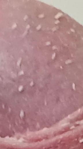Smegma Foreskin Roll. bigpisser