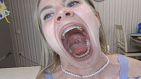Big mouth yawns widely! MP4