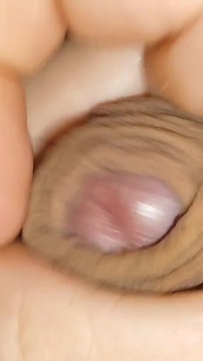 The World's Largest Foreskin Opening and Closing.