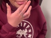 BEFORE AND AFTER FACIAL AFTERMATH