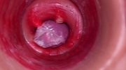 The camera inside the deep pussy records a huge ejaculation with a stuck condom