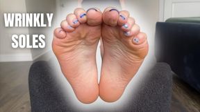 Wrinkly Soles