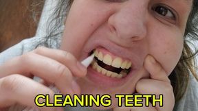Crooked Yellow Teeth Close-Up – Showing My Imperfections and Trying a Teeth Whitener On Camera