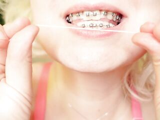 My 2nd day in braces: cleaning by dental floss