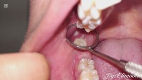 Dental check-up! Done by myself hehe
