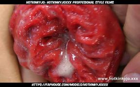 Hotkinkyjo's extreme anal insertion and prolapse push out