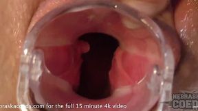 Blonde Teen Sarah Gets Gaped and Pees at Gyno Exam