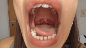 The Charm of the Uvula