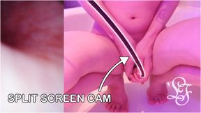 Endoscope POV inflated Bladder - Pissing in the Bathub