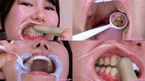 Kana Hoshi - Observing Kana's teeth with a dental mirror & brushing her teeth while wearing a mouth opener & finger toothbrushing while wearing a lip hook - MOV 1080p