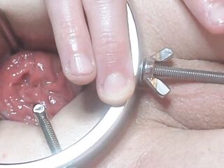 Amateur Anal Speculum and Rosebud Play