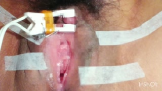 クリトリス 電気責め 吸引