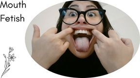 I open my huge mouth wide in a close-up just for you.. teeth crooked