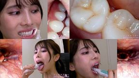 Tsubaki Hanai - Observing Tsubaki's teeth, mouth, and back of the throat with a dental camera - MOV 1080p