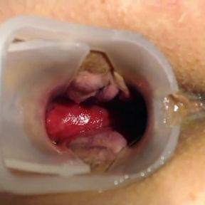 Fuck, strech and gape my asshole with big toys and fingers close up