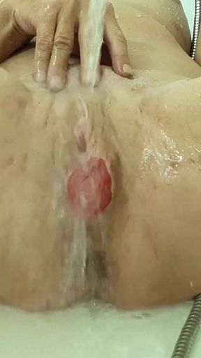 Lizzy Yum shocking post-op pussy