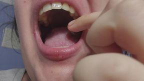 Extreme Close-Up Teeth Exploration – Showing My Real Teeth, Checking Cavities, Missing Tooth, and Removing Food with Tweezer, Intimate Dental Fetish Video
