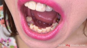 Inside My Mouth - Chanel Kiss - mouth examination and exploration part 1 (HD)