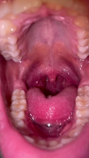 Mouth Tour No Makeup Teeth Tongue Uvula Tonsils Check