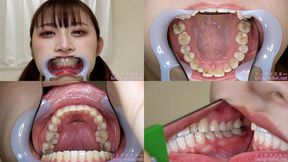 Misono - Watching Inside mouth of Japanese cute girl bite-267-1 - 1080p