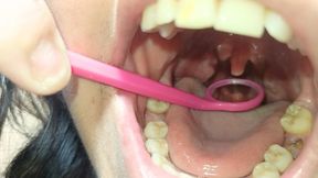 Exploring my uvula with objects copy