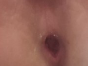 my anal is so lose and broken i cant hold anything in