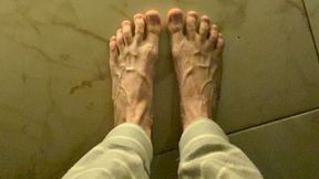 So swollen veins on the feet