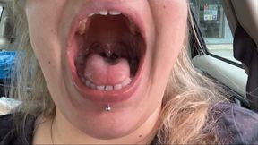 Post Dentist Mouth Tour with Novocaine 480p mp4