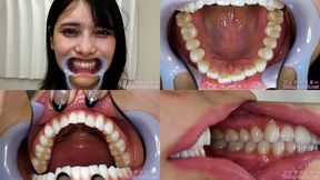 Mikana Mii - Watching Inside mouth of Japanese cute girl - 1080p