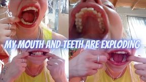 Examining my teeth
