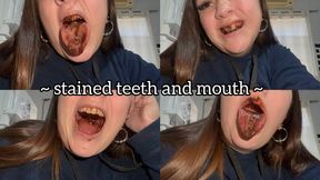 Stained teeth and mouth