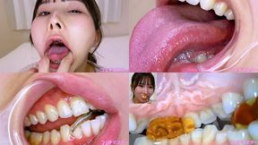 Kana Yura - Special Project - Even More Revealing Special Inside Oral Observation & Oral Fetish Play - 1080p