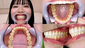Kanon Mashiro - Watching Inside mouth of Japanese cute girl - MOV 1080p