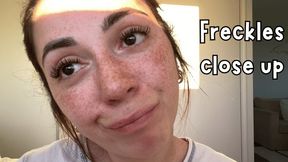 I'll show you my freckles up close! What do you think?