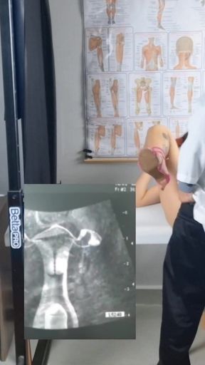 Memorable moment from &quot;The cuckold, the wife and the gynecologist naughty at the ultrasound!&quot;