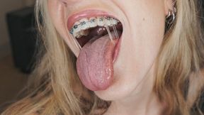 Try On: Wearing Elastics with Fake Braces