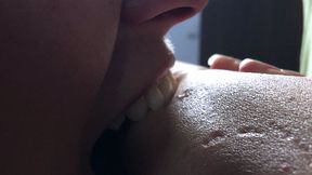 Bite - Biting Of Means Arms And Fingers - HD 1920x1080