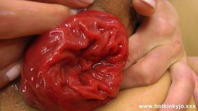 Total Destruction: Tight Teen's Anal&#x1F44C; Hole Gaping &mdash;  Cracking Open for Creampie Invasion