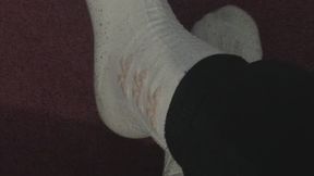 STAGES FEET IN BOW SOCKS