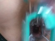 Masturbating with a speculum