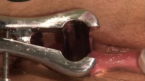 Dirty bitch needs to get punished, in the medical room. Part 2. She pissing on herself, and loves, when her gynecologist gets angry.